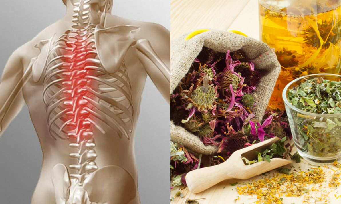 folk methods of osteochondrosis of the neck